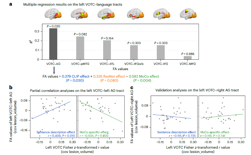 北京大学心理与认知科学学院毕彦超、朱毅鑫课题组揭示语言通过左侧角回通路调制人类视觉表征