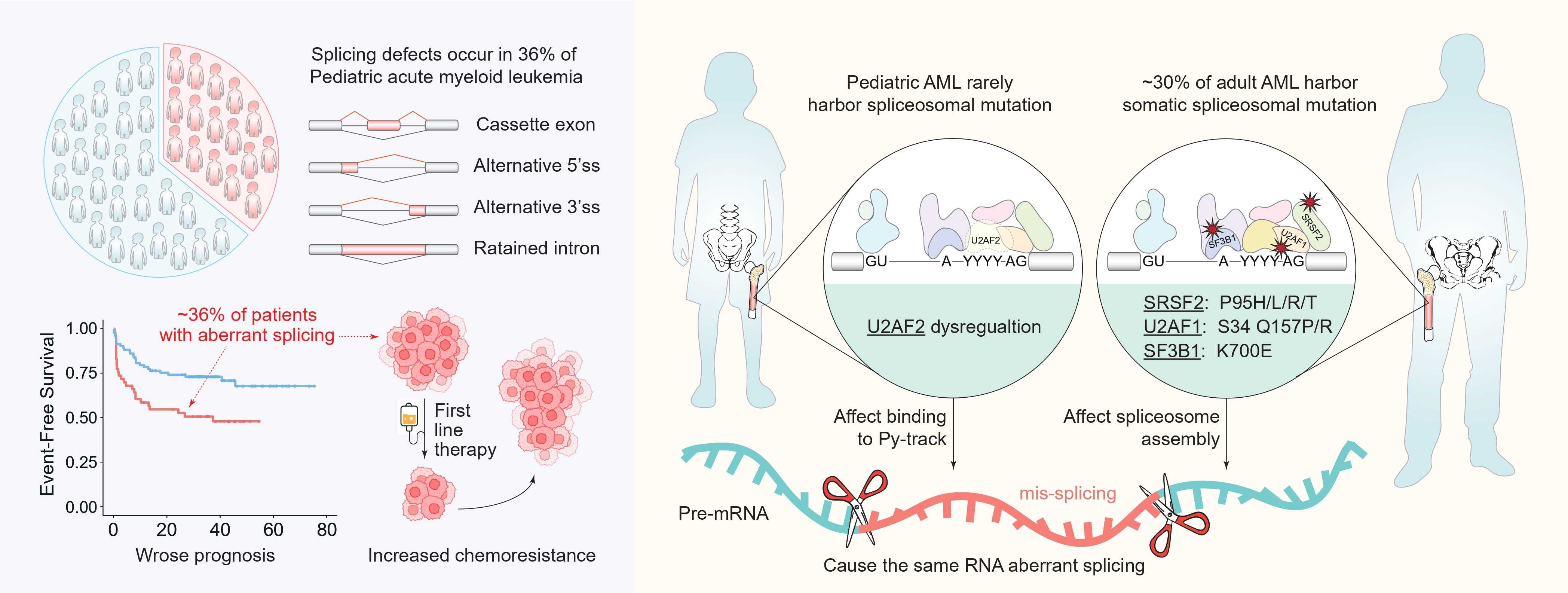 研究揭示基于剪接功能异常的儿童急性髓系白血病耐药新机制