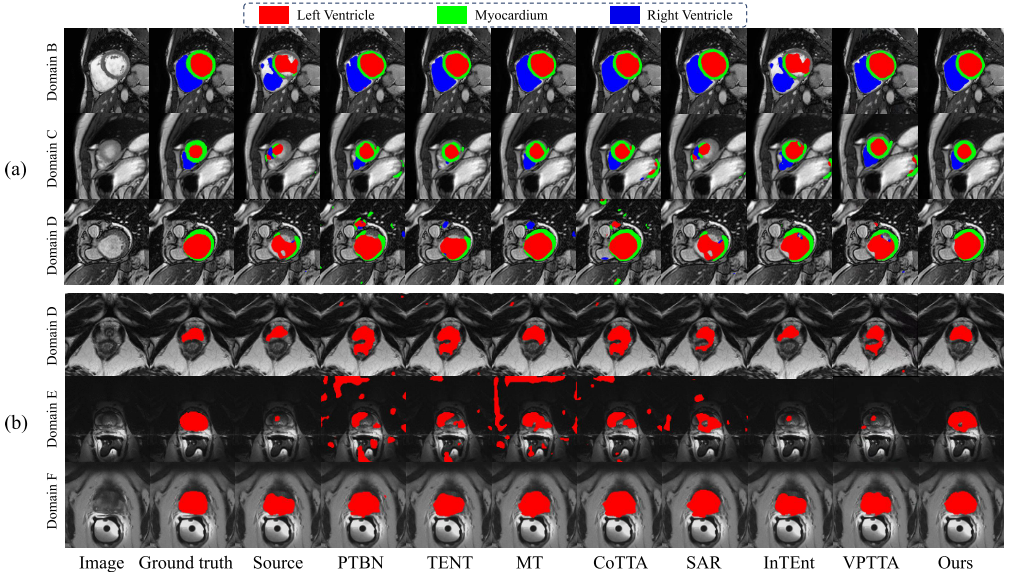 电子科技大学机电学院王国泰团队在人工智能顶级期刊IEEE TIP连续发表两项研究成果