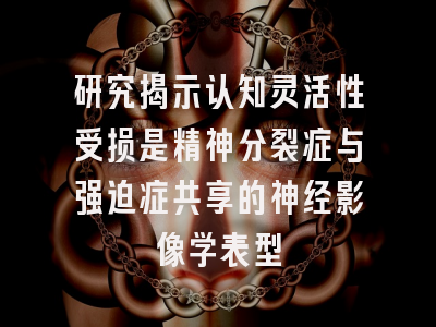 研究揭示认知灵活性受损是精神分裂症与强迫症共享的神经影像学表型