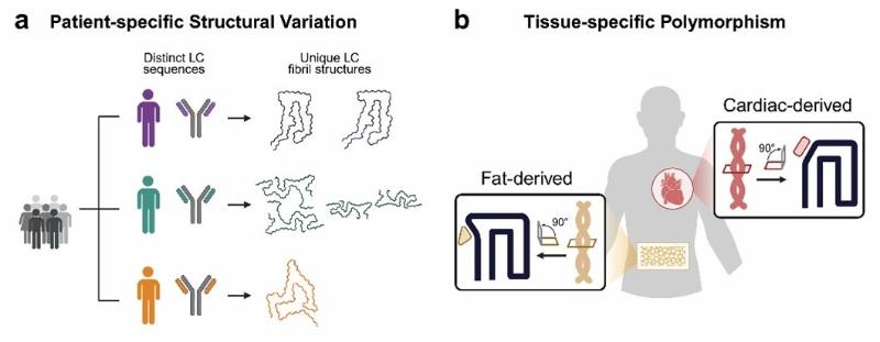 上海交大Bio-X研究院李丹团队与合作者开发基于病理聚集体的轻链淀粉样变性病活检诊断新方法