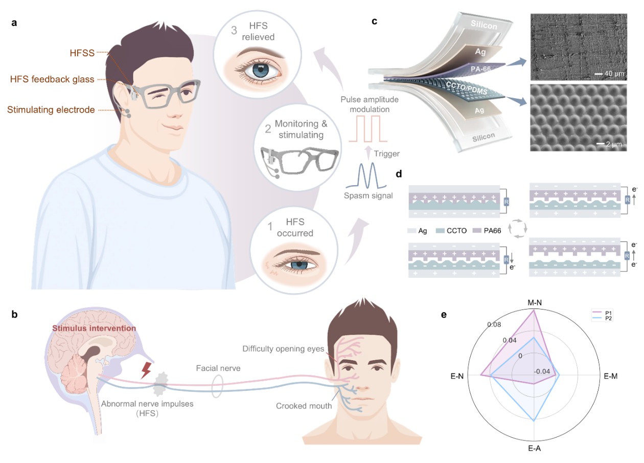 清华大学生医工程学院李翀团队合作实现基于非侵入式神经刺激的面肌痉挛监测及干预新途径