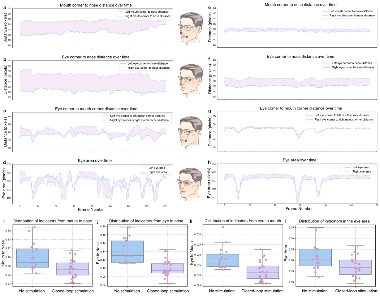 清华大学生医工程学院李翀团队合作实现基于非侵入式神经刺激的面肌痉挛监测及干预新途径