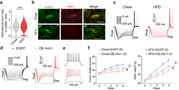 研究发现高脂饮食导致外侧隔核功能失调进而加剧肥胖的新机制