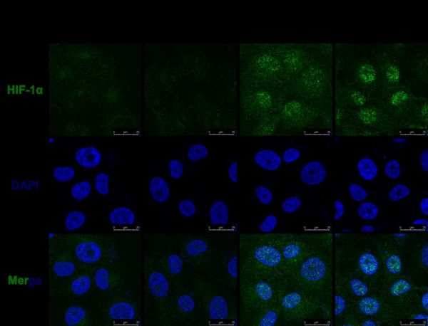 研究揭示抗病毒天然免疫关键因子IRF3调控低氧信号转导新机制