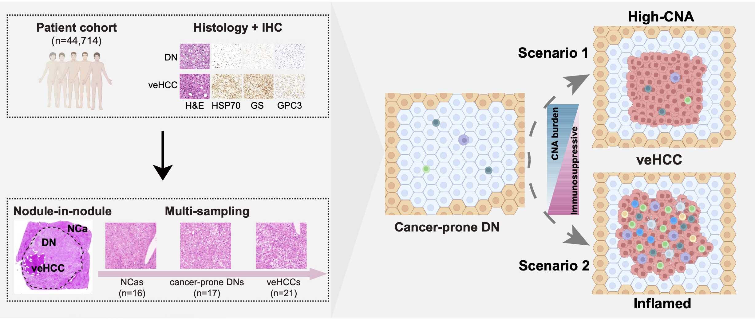 研究人员解析肝癌早期恶性转变的分子与免疫演化规律