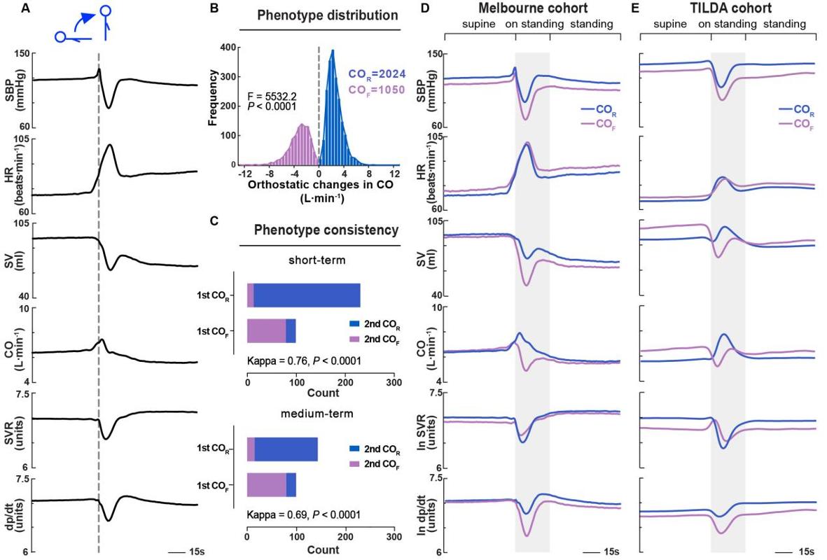 西安交大联合国际团队发现站立心输出量应答新表型