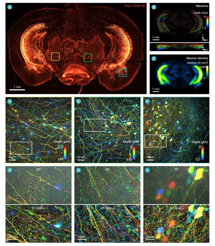 西安交大雷铭教授团队在结构光照明三维成像领域取得新进展