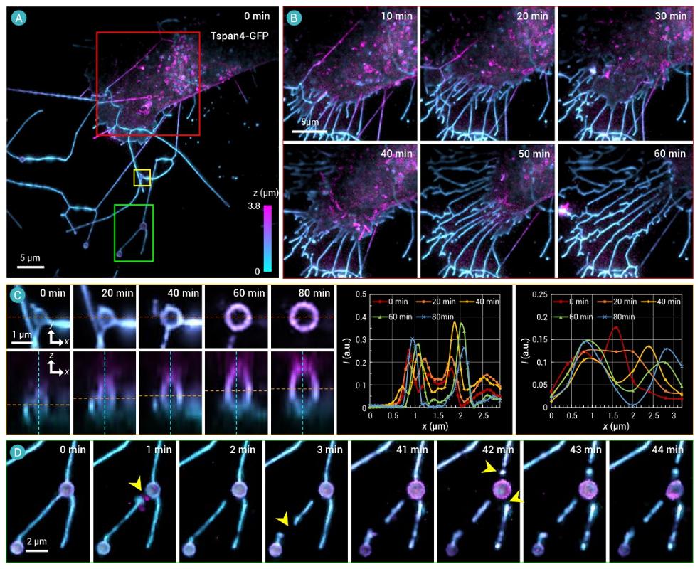 西安交大雷铭教授团队在结构光照明三维成像领域取得新进展