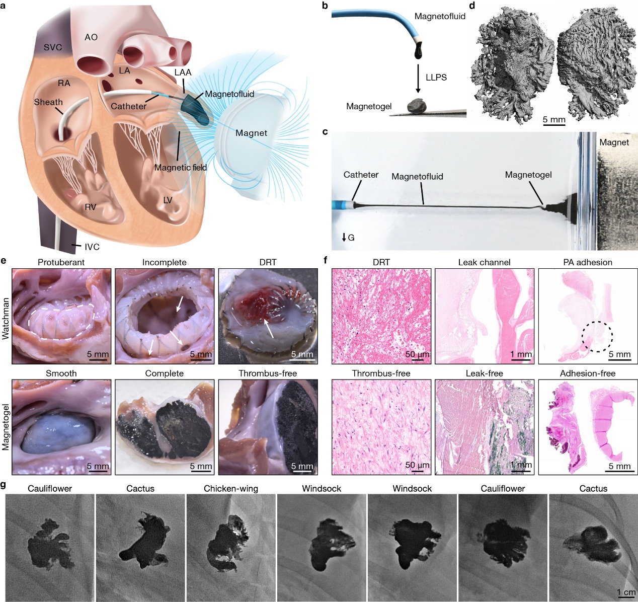 新型磁流体机器人破解临床难题