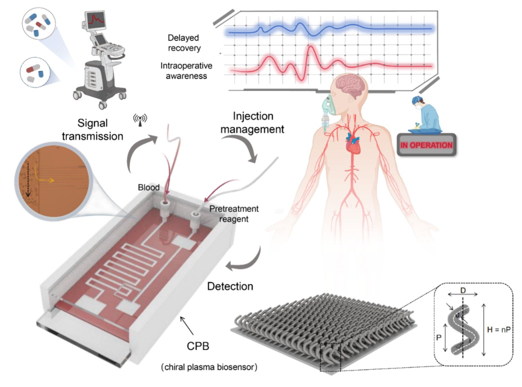 中国科大构建用于临床麻醉管理的手性光学传感器