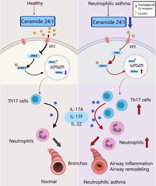 北京大学北京大学第三医院常春教授团队发表成果揭示哮喘新机制