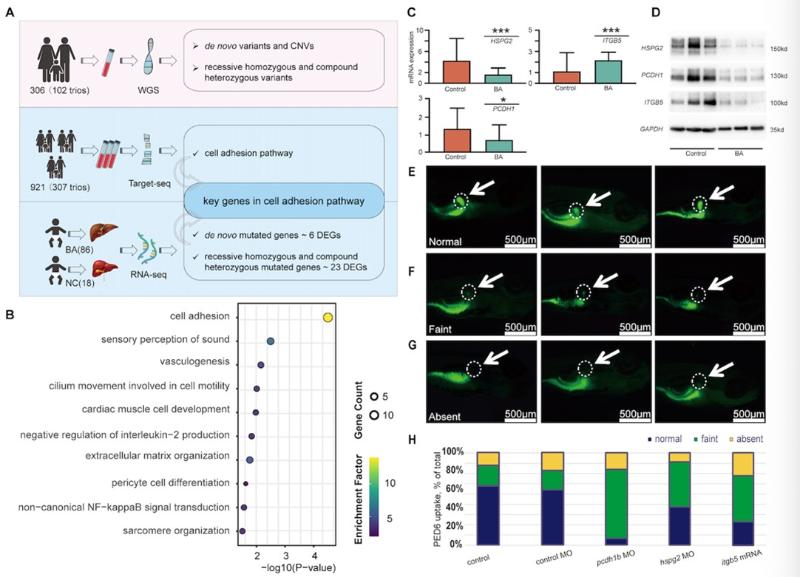上海交大Bio-X研究院秦胜营团队与合作者揭示细胞黏附通路异常为胆道闭锁核心发病机制