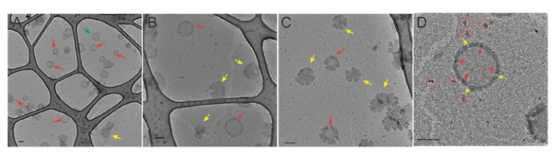 上海交大药学院马步勇课题组：破解阿尔茨海默病关键毒性结构和抗体识别机制