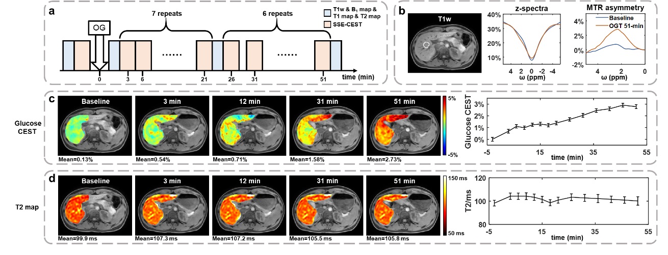清华大学生医工程学院宋小磊团队合作研发单次屏气腹部3D高清代谢核磁共振成像