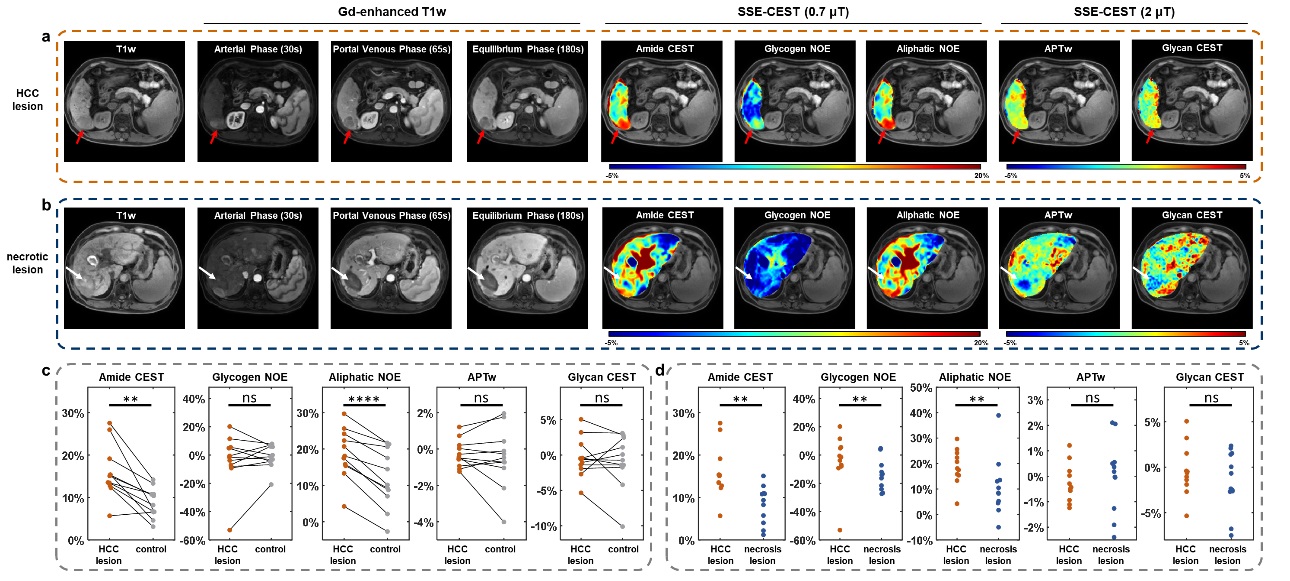 清华大学生医工程学院宋小磊团队合作研发单次屏气腹部3D高清代谢核磁共振成像