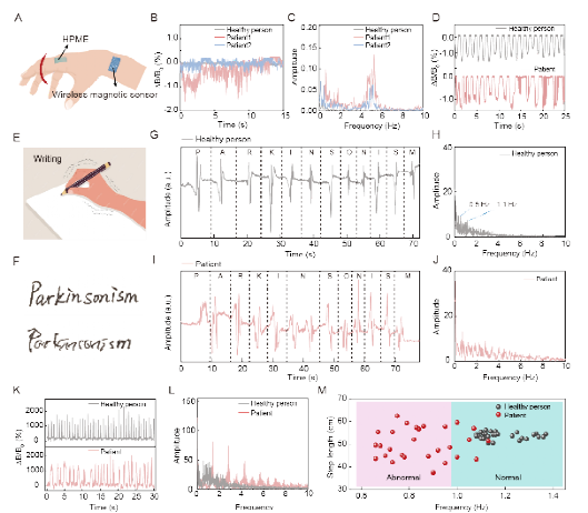西安交大张晓慧团队 在基于超柔可拉伸永磁弹性体的无线矢量运动监测研究方面取得新进展