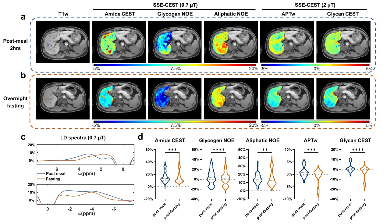 清华大学生医工程学院宋小磊团队合作研发单次屏气腹部3D高清代谢核磁共振成像