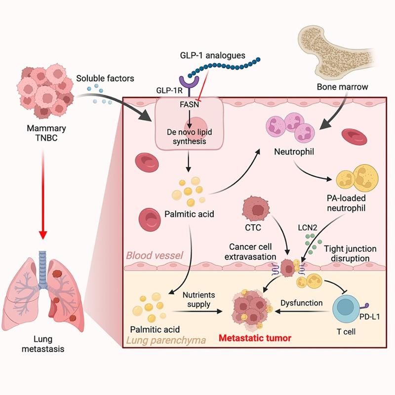 南京大学南京大学医学院魏继武团队揭示棕榈酸介导的肺转移前生态位形成机制及干预策略