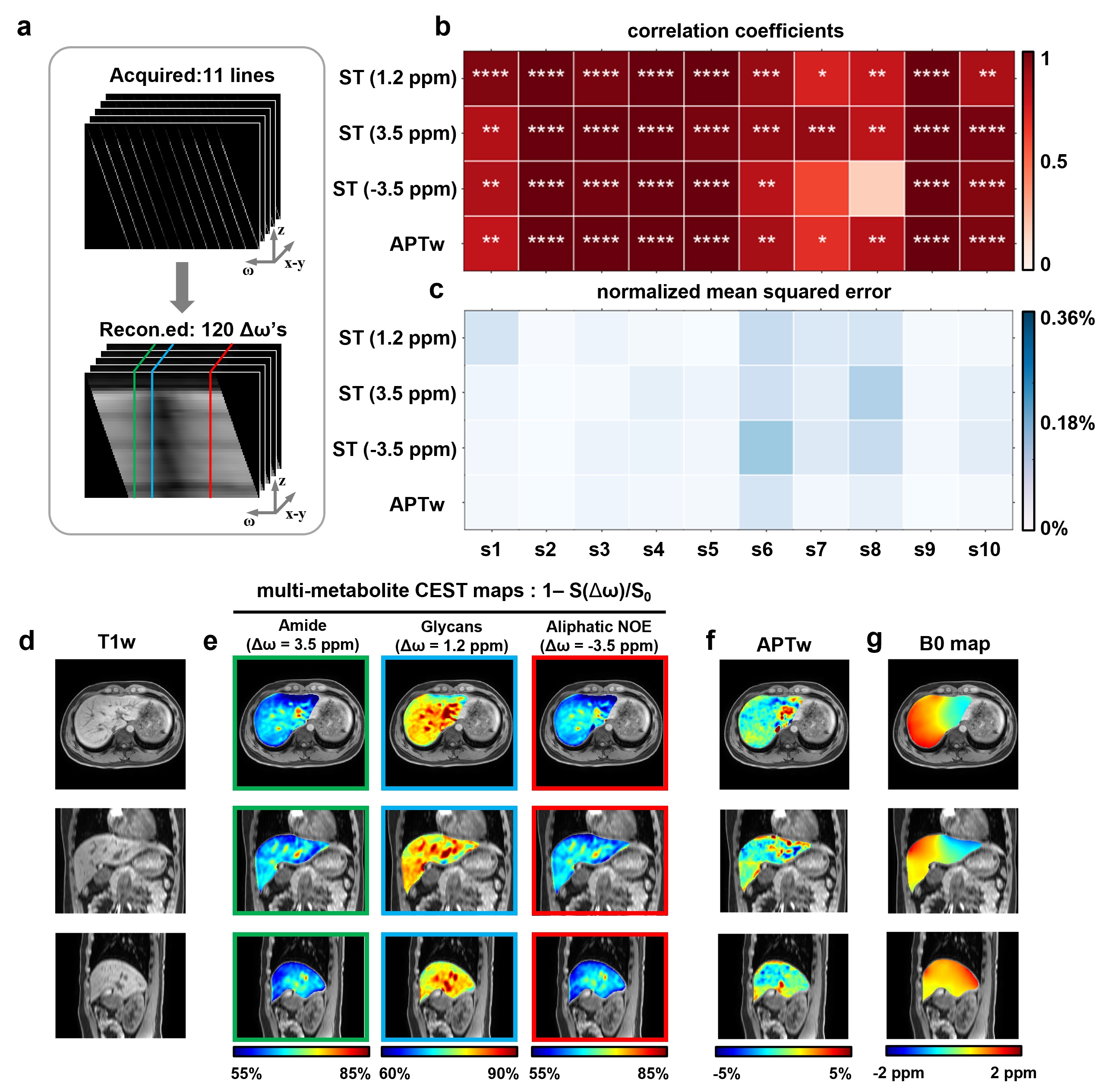 清华大学生医工程学院宋小磊团队合作研发单次屏气腹部3D高清代谢核磁共振成像
