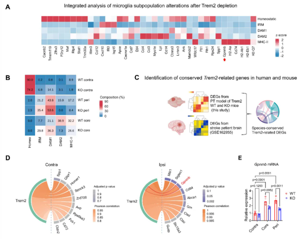 研究揭示调控缺血性脑卒中后神经炎症新机制