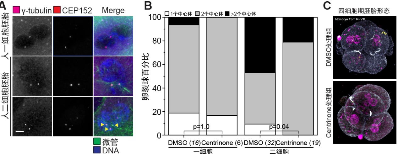 清华大学生物医学交叉研究院苏俊团队合作揭示人类试管胚胎早期发育停滞的两大原因