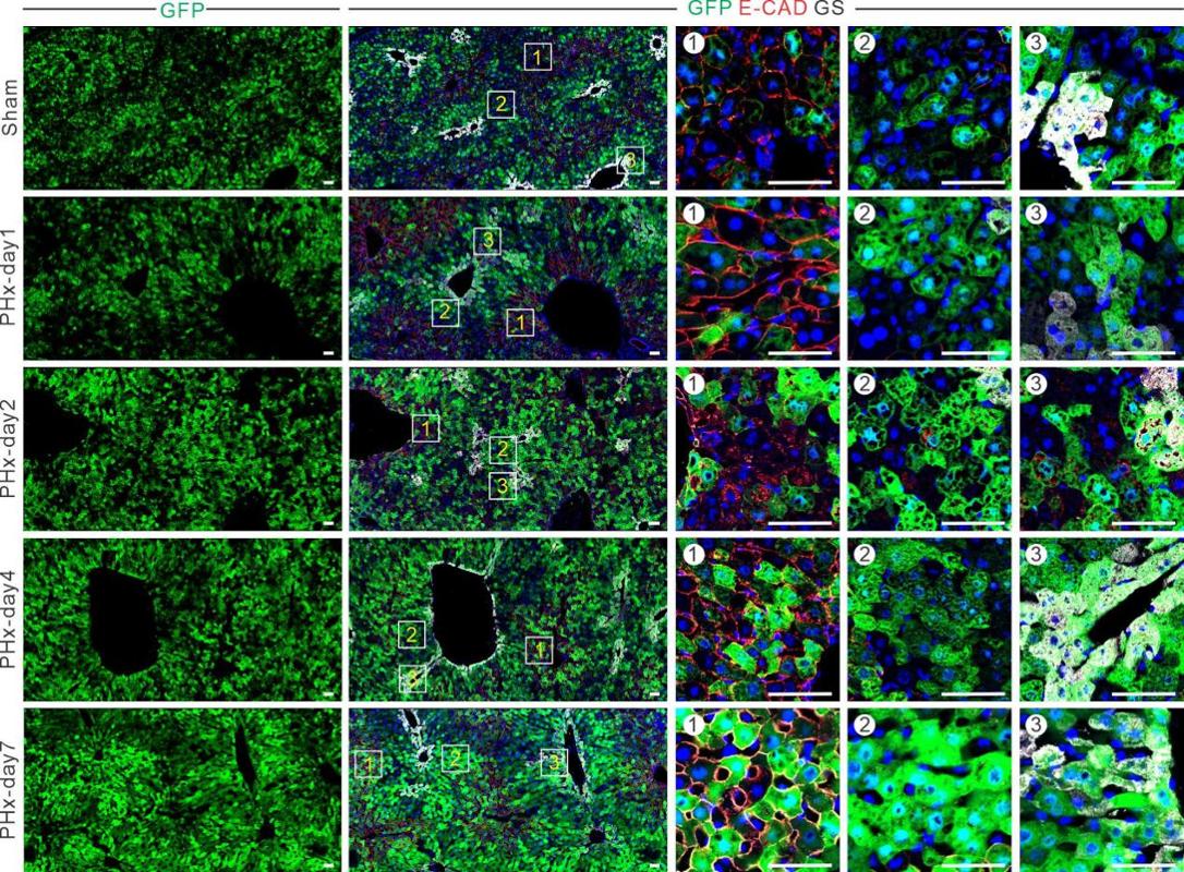西安交大一附院王胜鹏、袁祖贻、张谞丰团队与合作者Science发文 首次从力学感知视角揭示器官再生全新机制